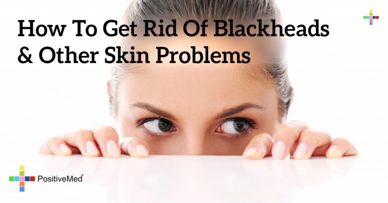 How to Get Rid Of Blackheads & Other Skin Problems