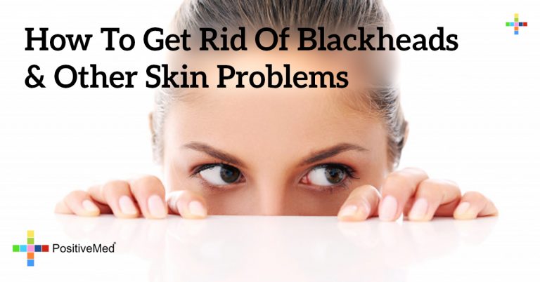 How to Get Rid Of Blackheads & Other Skin Problems How to Get Rid Of Blackheads & Other Skin Problems