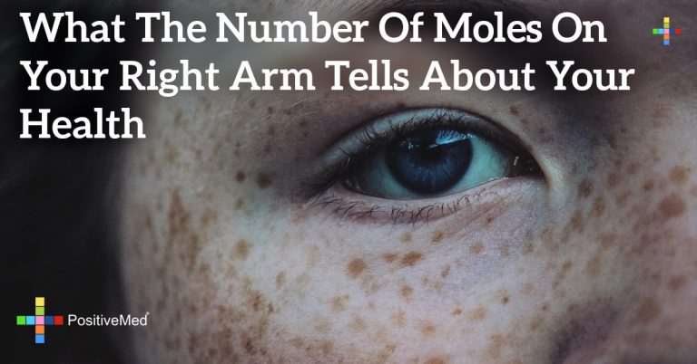 What the Number of Moles on your Right Arm Tells About your Health What the Number of Moles on your Right Arm Tells About your Health