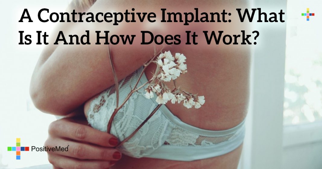 A Contraceptive Implant What Is It and How Does It Work? PositiveMed
