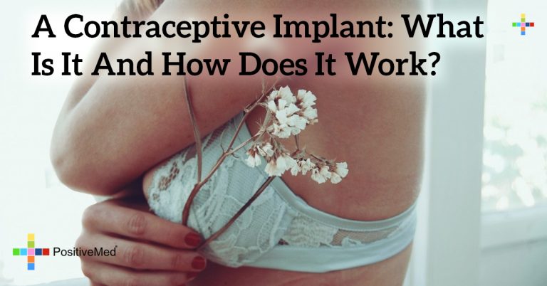A Contraceptive Implant: What Is It and How Does It Work?