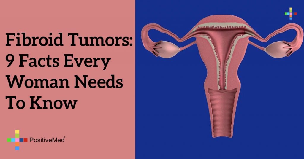 Fibroid Tumors: 9 Facts Every Woman Needs To Know