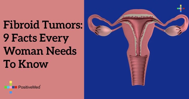 Fibroid Tumors: 9 Facts Every Woman Needs To Know Fibroid Tumors: 9 Facts Every Woman Needs To Know