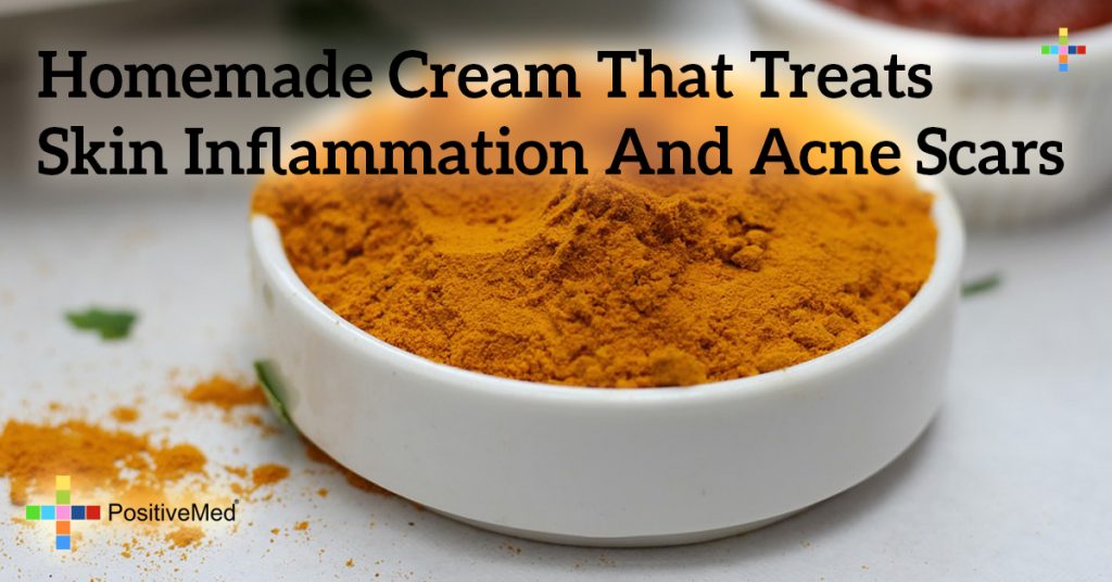 Homemade Cream That Treats Skin Inflammation and Acne Scars