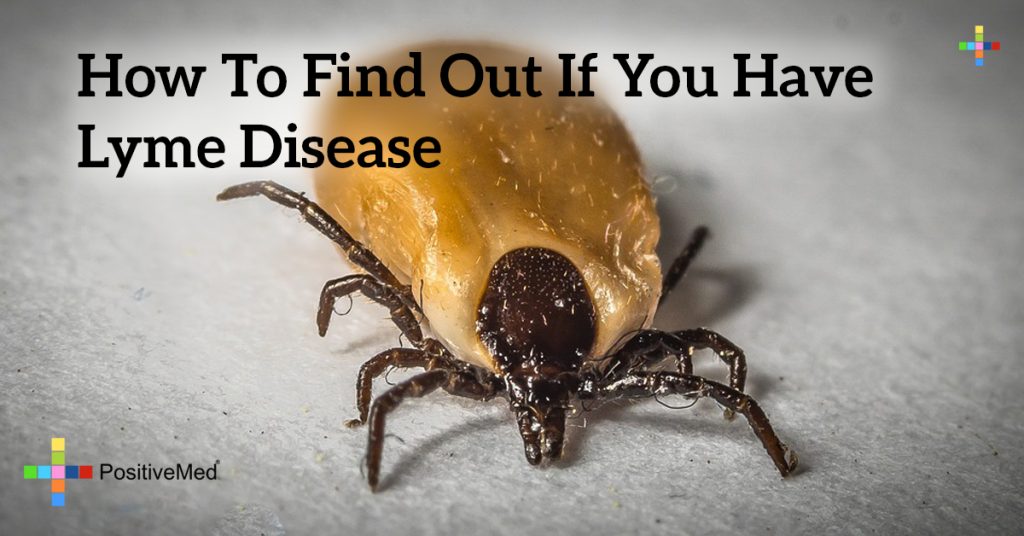 How to Find Out if You Have Lyme Disease