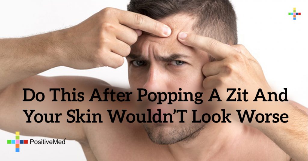 Do THIS After Popping a Zit and Your Skin Wouldn’t Look Worse