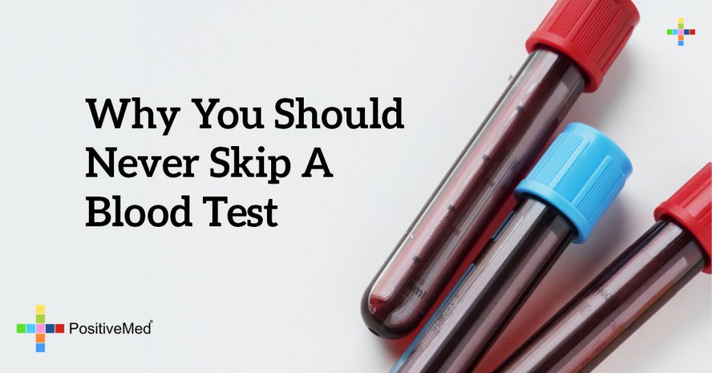 Why You Should Never Skip a Blood Test