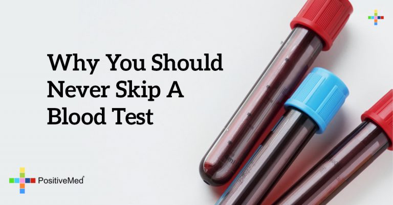 Why You Should Never Skip a Blood Test Why You Should Never Skip a Blood Test