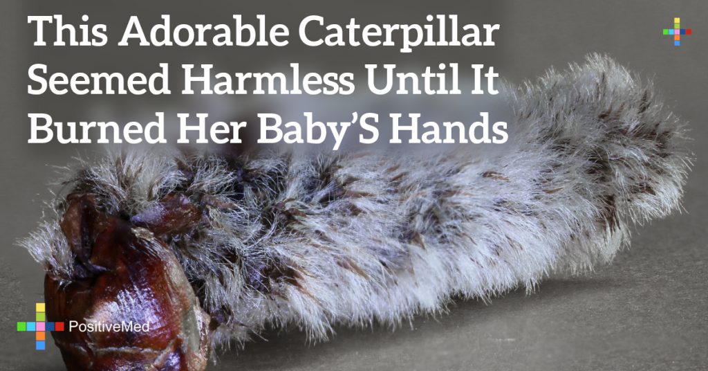 This Adorable Caterpillar Seemed Harmless Until It Burned Her Baby’s Hands
