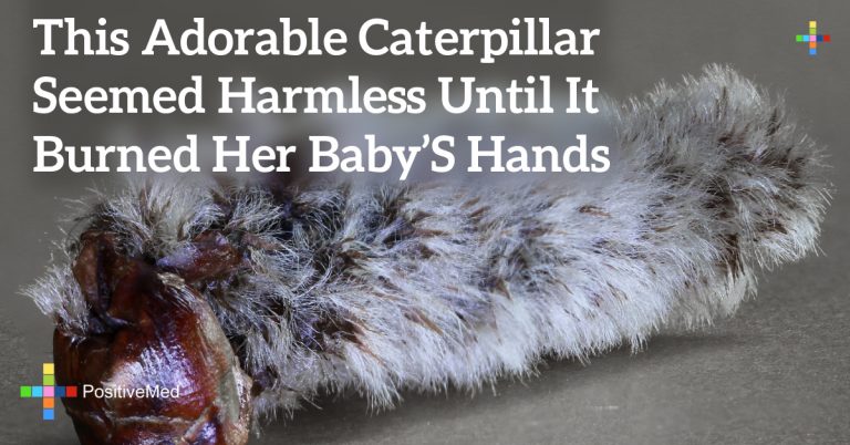 This Adorable Caterpillar Seemed Harmless Until It Burned Her Baby’s Hands This Adorable Caterpillar Seemed Harmless Until It Burned Her Baby’s Hands