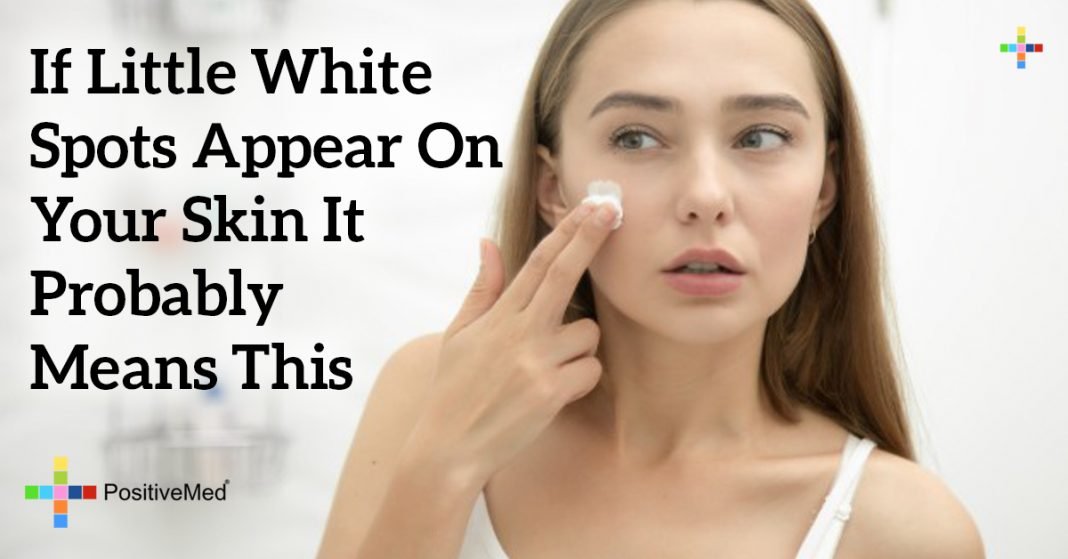 If Little White Spots Appear On Your Skin It Probably Means This