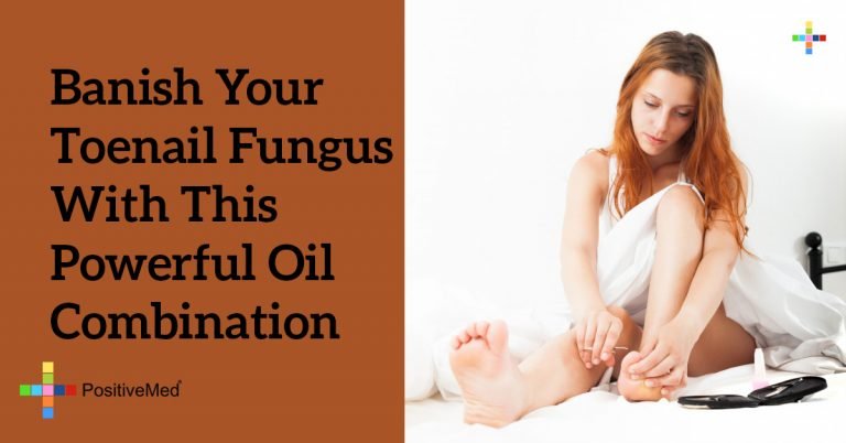 Banish Your Toenail Fungus With THIS Powerful Oil Combination