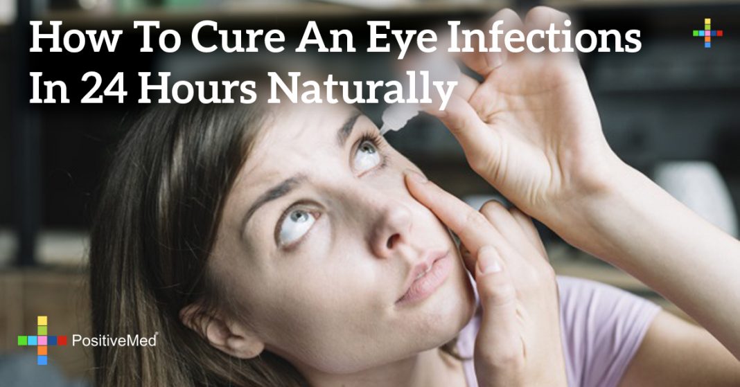 How to Cure an Eye Infections in 24 Hours Naturally PositiveMed