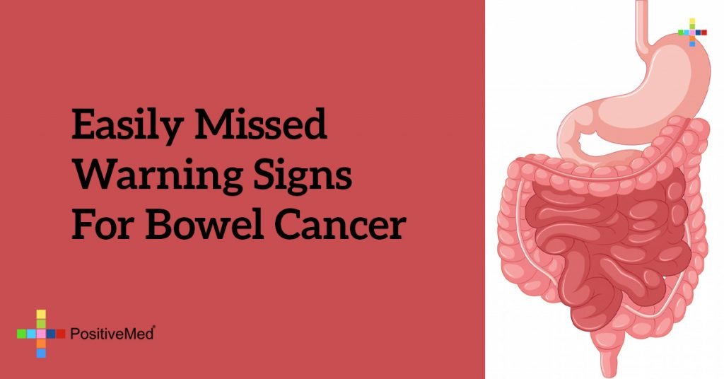Easily Missed Warning Signs for Bowel Cancer