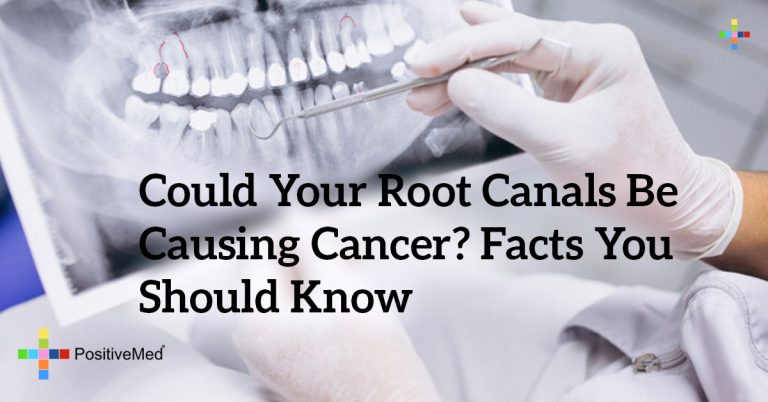 Could Your Root Canals Be Causing Cancer? Facts You Should Know