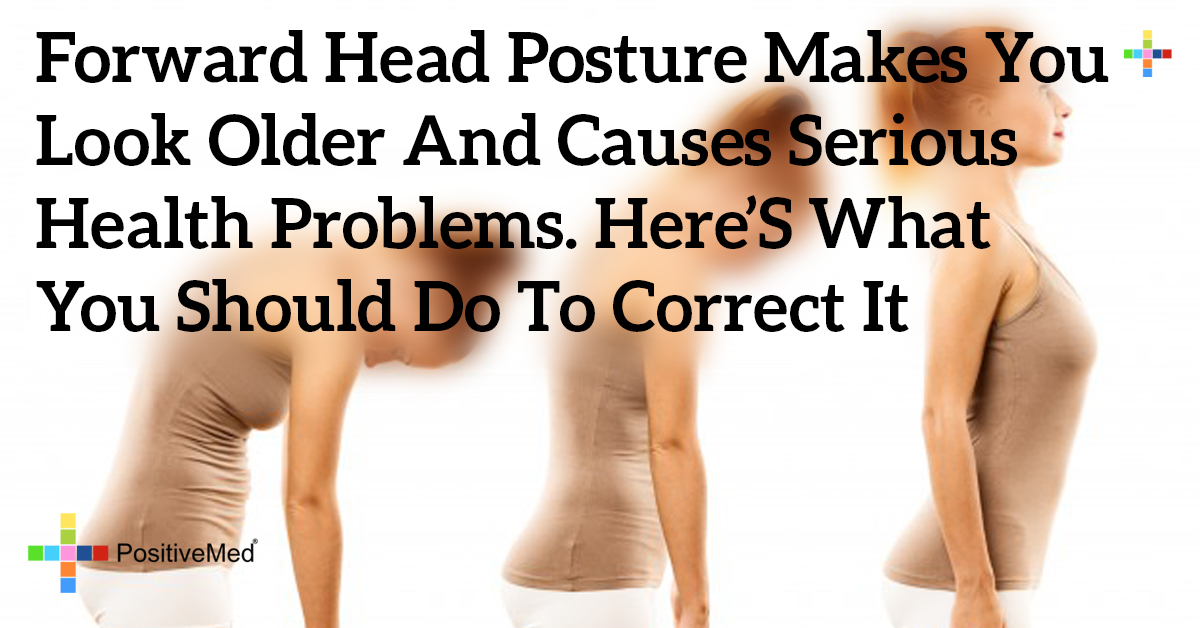 Forward Head Posture Makes You Look Older and Causes Serious Health Problems. Here's What You