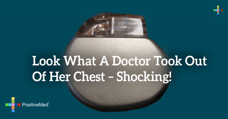 Look What a Doctor Took Out of Her Chest – Shocking! Look What a Doctor Took Out of Her Chest – Shocking!