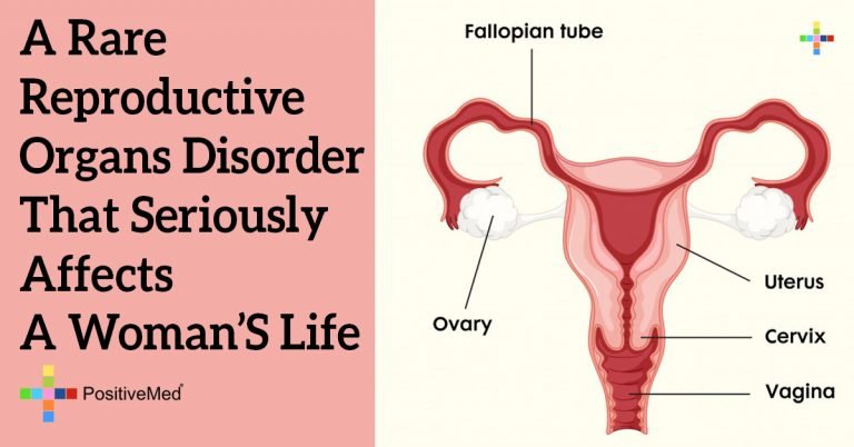 A Rare Reproductive Organs Disorder that Seriously Affects a Woman’s Life