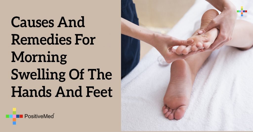 Causes and Remedies for Morning Swelling of the Hands and Feet