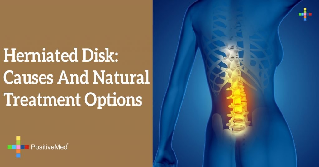 Herniated Disk: Causes and Natural Treatment Options