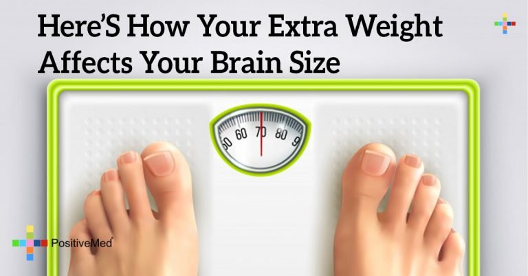 Here’s How Your Extra Weight Affects Your Brain Size Here’s How Your Extra Weight Affects Your Brain Size