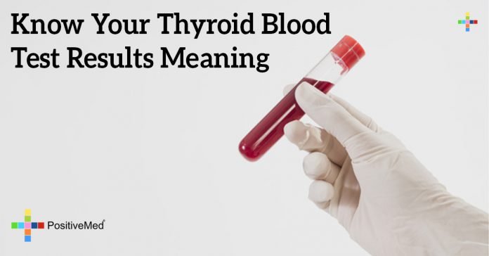 Know Your Thyroid Blood Test Results Meaning PositiveMed