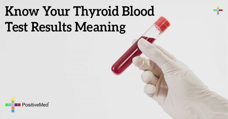 Know Your Thyroid Blood Test Results Meaning Know Your Thyroid Blood Test Results Meaning