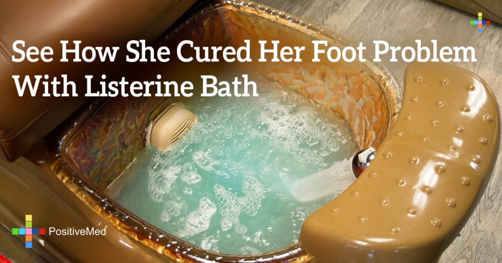 See How She Cured Her Foot Problem With Listerine Bath