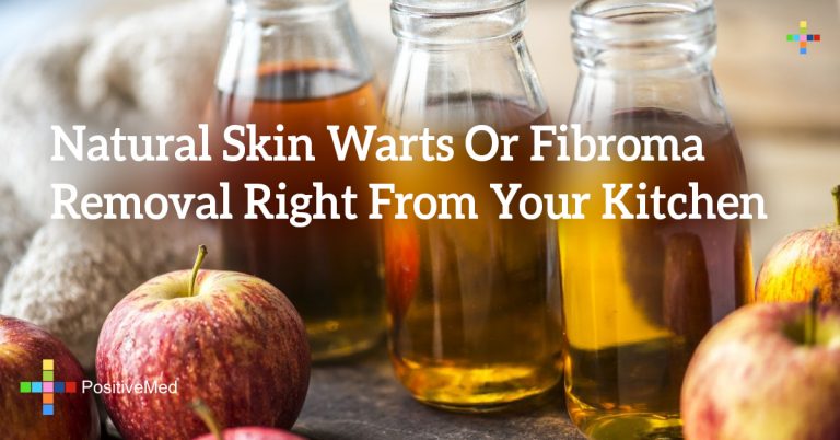 Natural Skin Warts Or Fibroma Removal Right From Your Kitchen