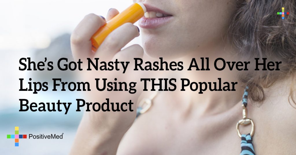 She’s Got Nasty Rashes All Over Her Lips From Using THIS Popular Beauty Product
