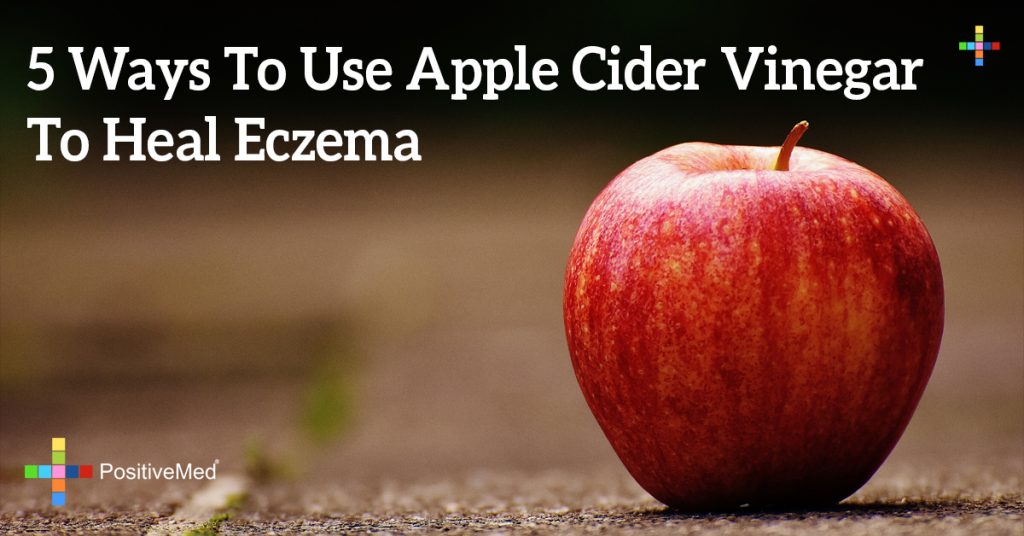 5 Ways To Use Apple Cider Vinegar To Heal Eczema