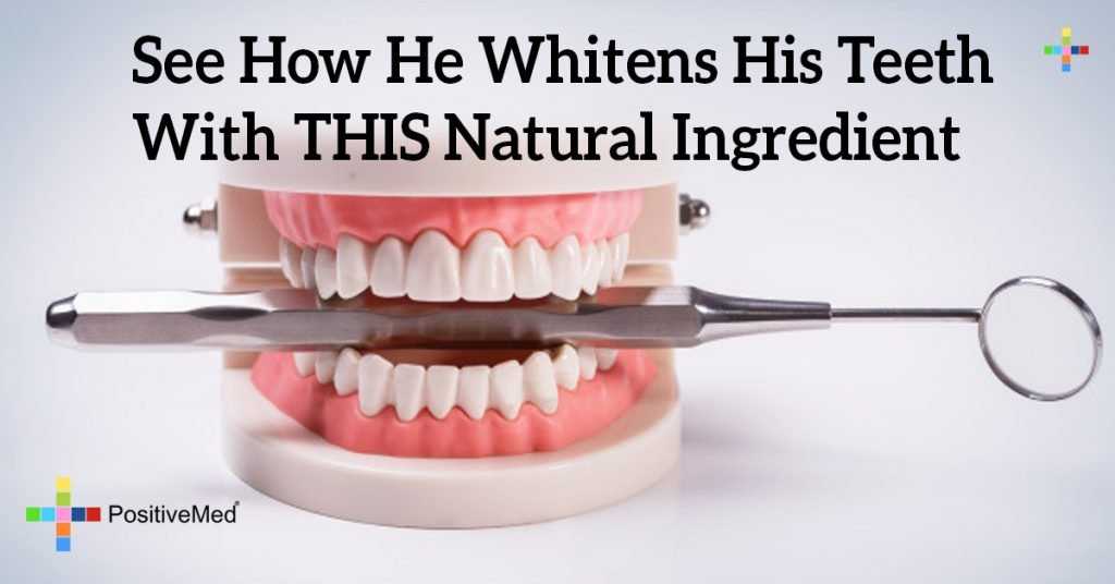 See How He Whitens His Teeth With THIS Natural Ingredient