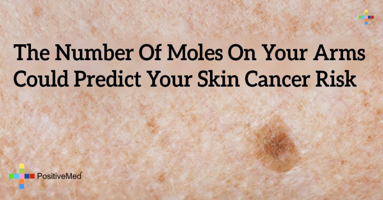 The Number Of Moles On Your Arms Could Predict Your Skin Cancer Risk
