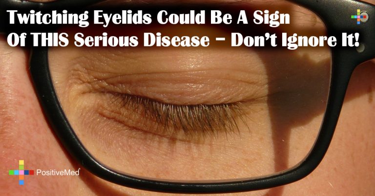 Twitching Eyelids Could Be A Sign Of THIS Serious Disease – Don’t Ignore It! Twitching Eyelids Could Be A Sign Of THIS Serious Disease – Don’t Ignore It!