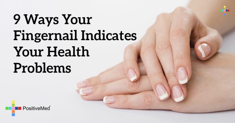 9 Ways Your Fingernail Indicates Your Health Problems 9 Ways Your Fingernail Indicates Your Health Problems
