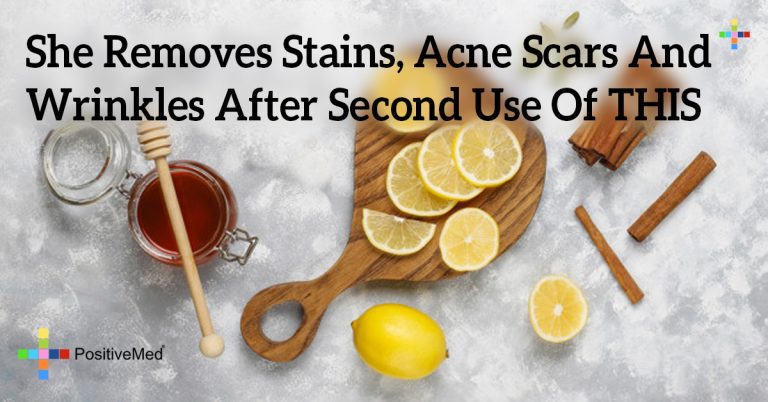 She Removes Stains, Acne Scars And Wrinkles After Second Use Of THIS