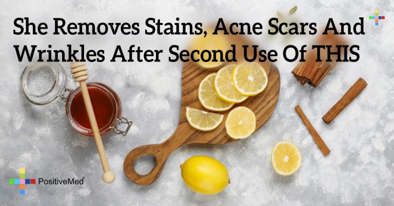 She Removes Stains, Acne Scars And Wrinkles After Second Use Of THIS She Removes Stains, Acne Scars And Wrinkles After Second Use Of THIS