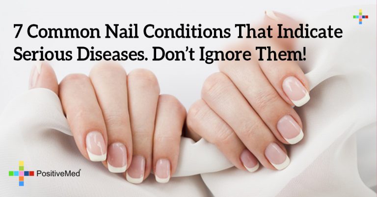 7 Common Nail Conditions That Indicate Serious Diseases. Don’t Ignore Them!