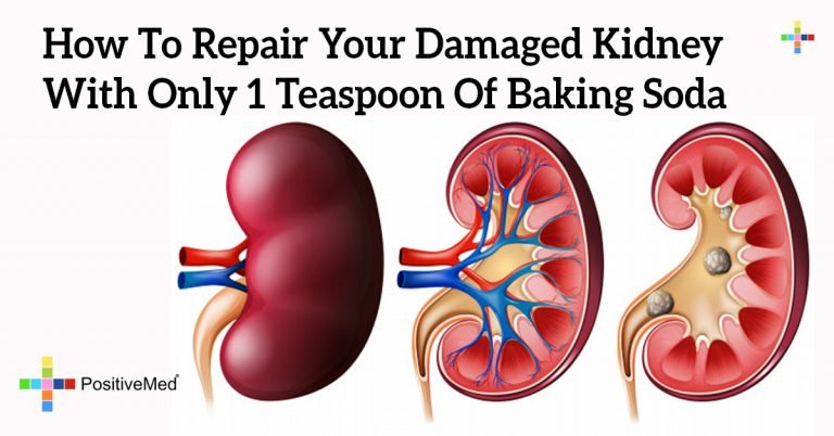 How To Repair Your Damaged Kidney With Only 1 Teaspoon Of Baking Soda How To Repair Your Damaged Kidney With Only 1 Teaspoon Of Baking Soda
