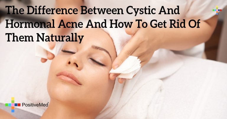The Difference Between Cystic And Hormonal Acne And How To Get Rid Of Them Naturally