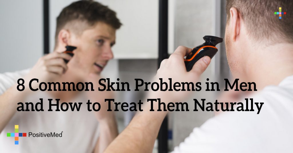 8 Common Skin Problems in Men and How to Treat Them Naturally