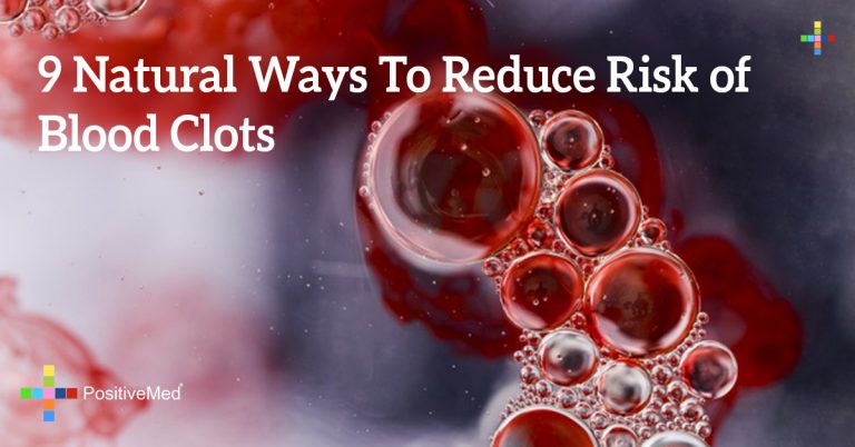 9 Natural Ways To Reduce Risk of Blood Clots 9 Natural Ways To Reduce Risk of Blood Clots