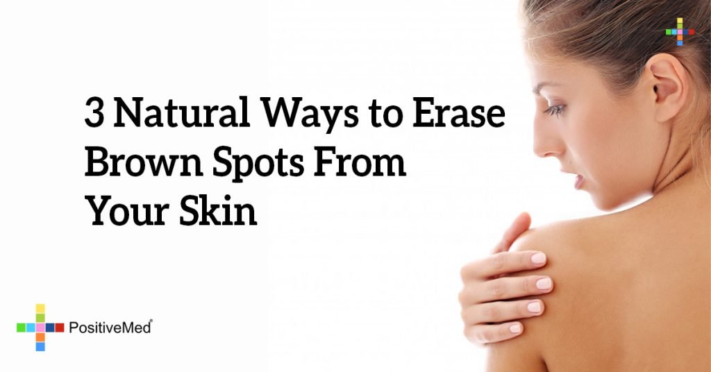 3 Natural Ways to Erase Brown Spots From Your Skin