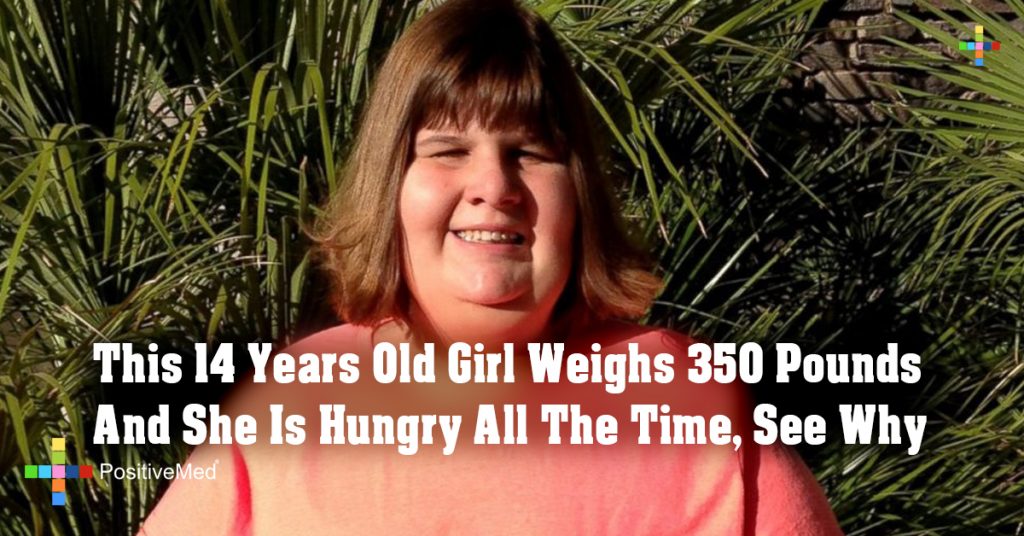 This 14 Years Old Girl Weighs 350 Pounds And She Is Hungry All The Time, See Why