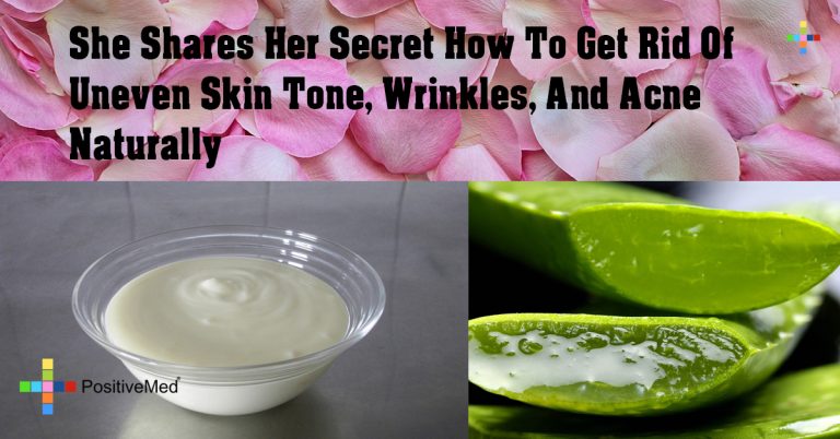 She Shares Her Secret How To Get Rid Of Uneven Skin Tone, Wrinkles, And Acne Naturally