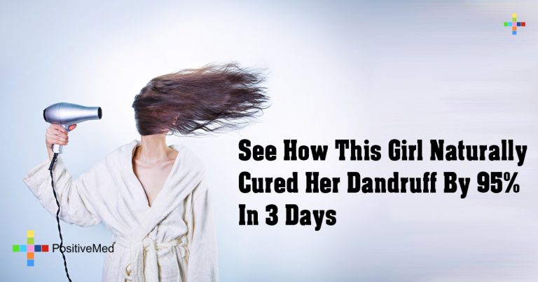 See How This Girl Naturally Cured Her Dandruff By 95% In 3 Days See How This Girl Naturally Cured Her Dandruff By 95% In 3 Days