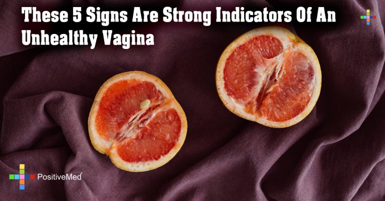 These 5 Signs Are Strong Indicators Of An Unhealthy Vagina