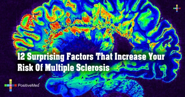 12 Surprising Factors That Increase Your Risk Of Multiple Sclerosis
