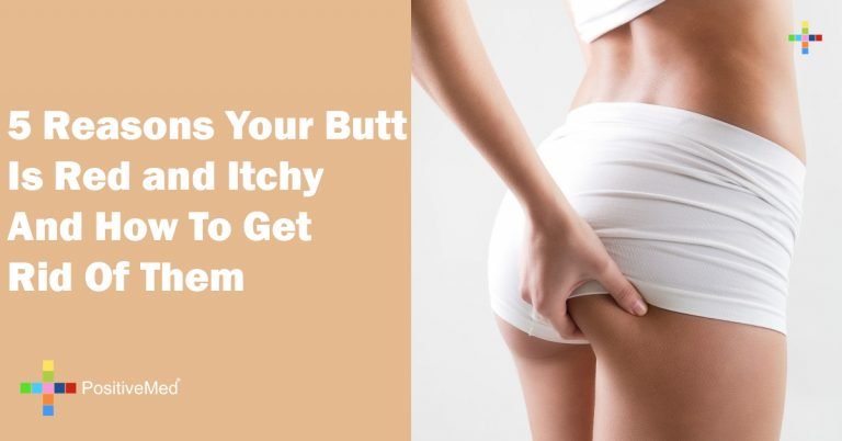 5 Reasons Your Butt Is Red and Itchy And How To Get Rid Of Them