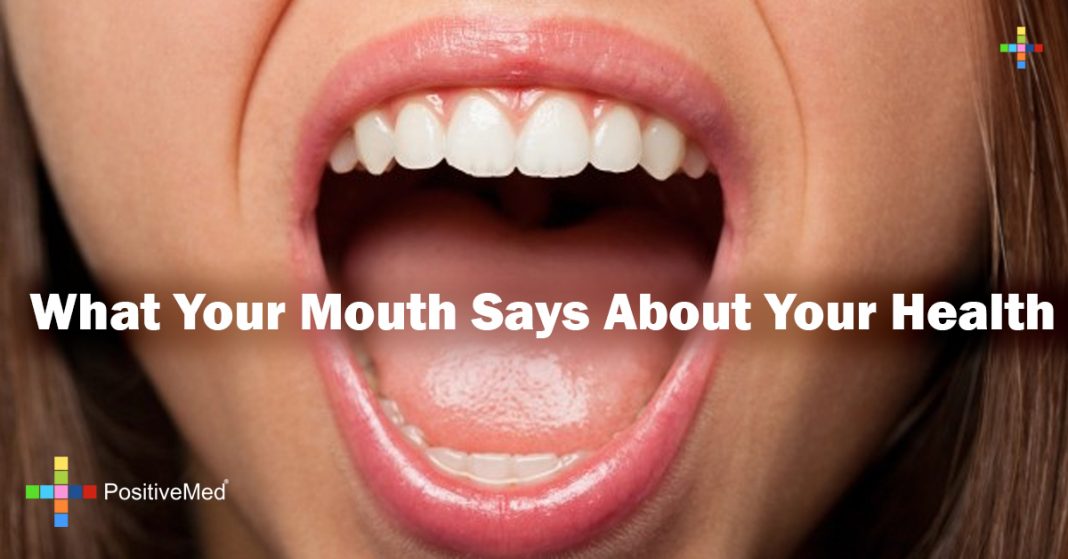 What Your Mouth Says About Your Health